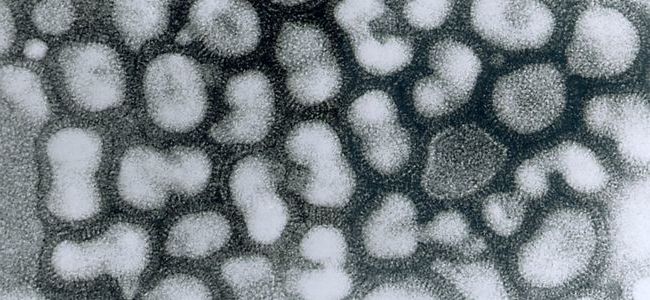 Гонконгский вирус гриппа признаки и симптомы