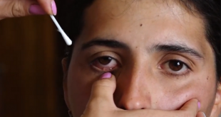 Секрет армянки Сатеник Казарян, которая плачет "кристаллами" раскрыт - эксперты провели анализ камней из глаз девушки