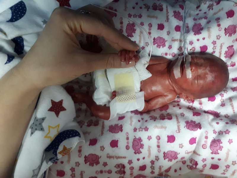 На Тернопольщине врачи перинатального центра спасли девочку, которая родилась весом 610 граммов