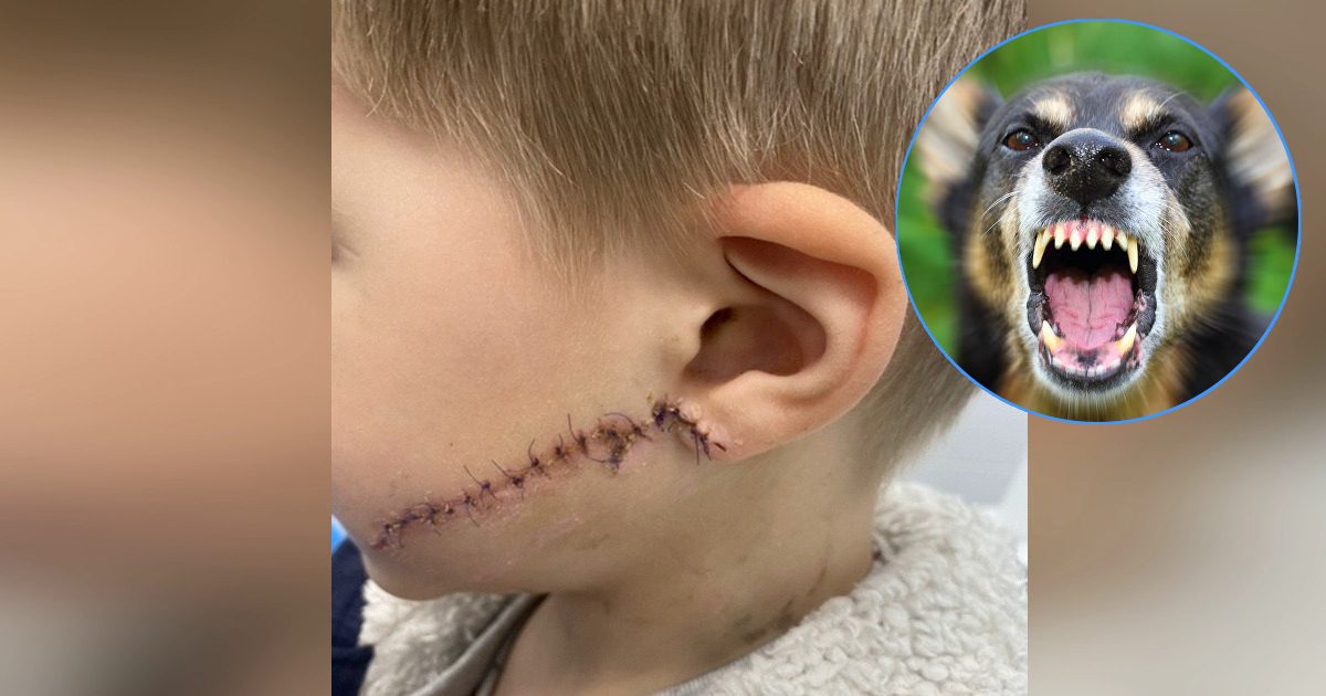 В Днепре домашняя собака искусала лицо 5-летнему ребенку: врачи спасали мальчика