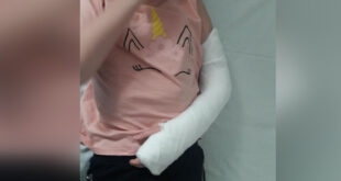 В Мелитополе ребенку пришлось ломать руку: сначала врачи приписали лечить двойной перелом мазями и бинтом