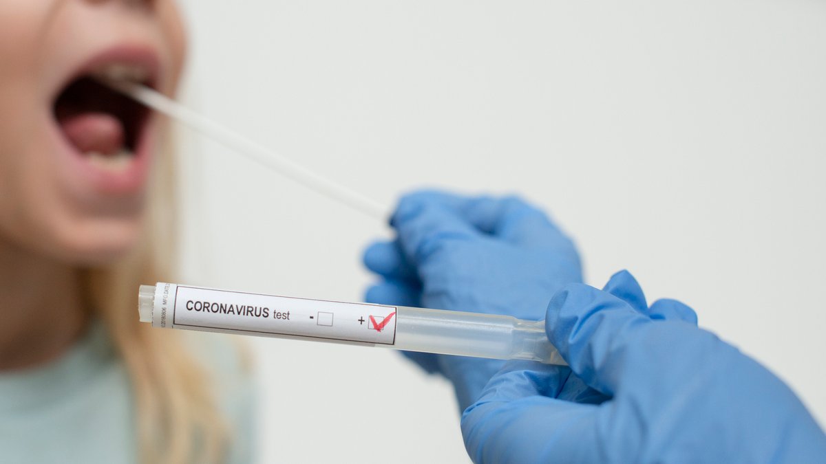 Как бесплатно сдать ПЦР-тест на коронавирус в Украине: министр здравоохранения объяснил тонкости