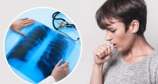 Как отличить пневмонию от простуды: врач назвал симптомы пневмонии, которые отличают ее от простуды