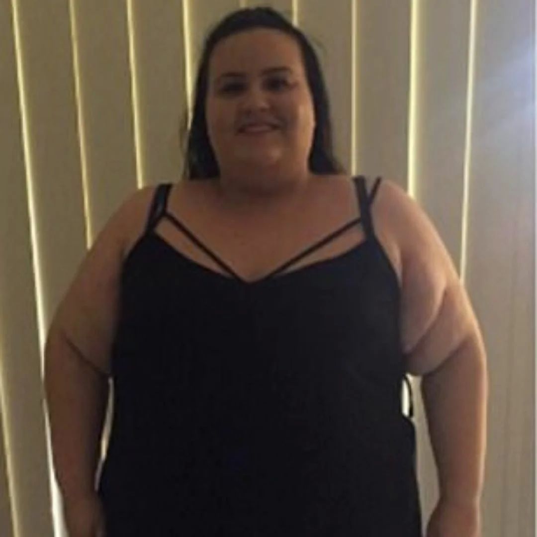 Девушка похудела на 90 кг за год отказавшись от одного вида продуктов: фото до и после диеты шокируют
