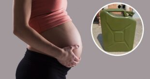 В Кривом Роге 17-летний изверг облил бензином и поджег свою беременную девушку: пострадавшая в тяжелейшем состоянии