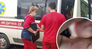 Мать даже не собиралась лечить: на Николаевщину спасли двухлетнюю девочку с ожогами кипятком