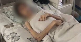 ФОТО: Житель Одессы морил 16-тилетнего сына голодом, называя это "духовным лечением" - ребенок был на грани смерти