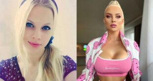 "Хочу быть как кукла Барби...": девушка в 20 лет потратила 50 тысяч долларов, чтобы изменить свою внешность